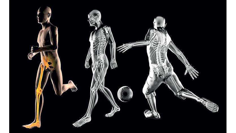 Workshop on 'Affordable Motion Capturing for Gait Analysis